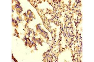 Immunohistochemistry of paraffin-embedded human lung tissue using ABIN7161472 at dilution of 1:100