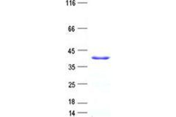 PRR5L Protein (His tag)