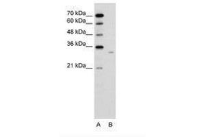 Image no. 2 for anti-Dicarbonyl/L-Xylulose Reductase (DCXR) (AA 151-200) antibody (ABIN6736636) (DCXR Antikörper  (AA 151-200))