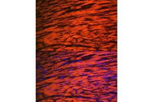 Immunofluorescence analysis of rat heart using MYL2 Rabbit mAb (ABIN7268761) at dilution of 1:100 (40x lens). (MYL2 Antikörper)