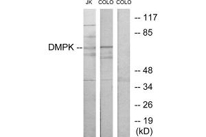Western blot analysis of extracts from Jurkat cells and COLO205 cells, using DMPK antibody. (DMPK Antikörper  (N-Term))