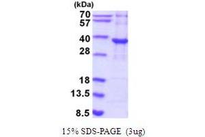 SDS-PAGE (SDS) image for Pyrroline-5-Carboxylate Reductase Family, Member 2 (PYCR2) (AA 1-320) protein (His tag) (ABIN5854206)