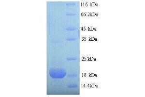 Erythropoietin (EPO) (AA 27-194), (full length) protein (His tag) (EPO Protein (AA 27-194, full length) (His tag))