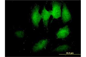 Immunofluorescence of monoclonal antibody to TOMM34 on HeLa cell.