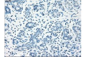 Immunohistochemical staining of paraffin-embedded breast tissue using anti-LTA4H mouse monoclonal antibody.