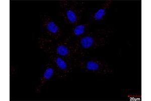 Confocal microscopy image of Proximity Ligation Assay of protein-protein interactions between PDGFRB and FLT1.