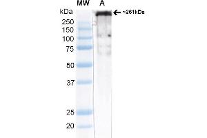 Western Blot analysis of Rat brain membrane lysate (native) showing detection of ~261 kDa Cav3. (CACNA1H Antikörper  (AA 1019-1293) (APC))
