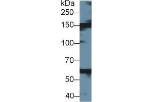 Western Blot; Sample: Bovine Liver lysate; Primary Ab: 1µg/ml Rabbit Anti-Bovine XDH Antibody Second Ab: 0. (XDH Antikörper  (AA 2-219))