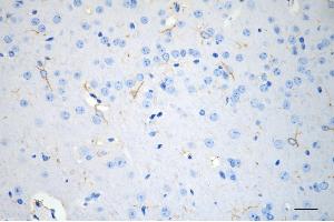 Immunohistochemistry was performed on paraffin-embedded mouse brain using kinesin light chain 1 antibody (ABIN7799210), 1:200). (Rekombinanter KLC1 Antikörper)