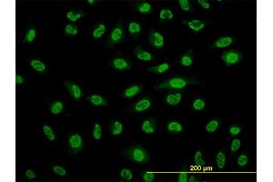 Immunofluorescence (IF) image for anti-Nuclear Factor of kappa Light Polypeptide Gene Enhancer in B-Cells 1 (NFKB1) (AA 860-969) antibody (ABIN561980)