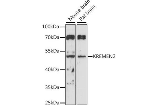 KREMEN2 Antikörper  (AA 200-360)