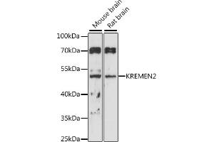 Western blot analysis of extracts of various cell lines, using KREMEN2 antibody (ABIN7268149) at 1:1000 dilution. (KREMEN2 Antikörper  (AA 200-360))