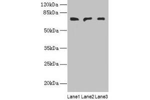 Western blot All lanes: PLCZ1 antibody at 3 μg/mL Lane 1: Mouse liver tissue Lane 2: Mouse kidney tissue Lane 3: Human placenta tissue Secondary Goat polyclonal to rabbit IgG at 1/10000 dilution Predicted band size: 71, 48, 58 kDa Observed band size: 71 kDa (PLCz1 Antikörper  (AA 1-415))
