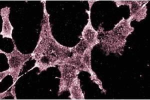 Immunofluorescences staining of RSV-3T3 cells. (RPS6KB1 Antikörper  (AA 2-121))