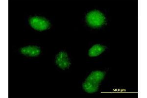 Immunofluorescence of purified MaxPab antibody to ZCCHC13 on HeLa cell. (ZCCHC13 Antikörper  (AA 1-166))