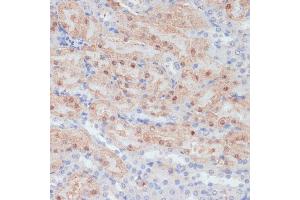 Immunohistochemistry of paraffin-embedded mouse kidney using CLDN17 antibody (ABIN7266407) at dilution of 1:100 (40x lens). (Claudin 17 Antikörper  (C-Term))