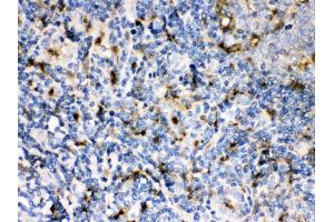 Anti- Cystatin A Picoband antibody, IHC(P) IHC(P): Human Tonsil Tissue (CSTA Antikörper  (AA 8-98))