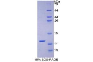 SDS-PAGE (SDS) image for Solute Carrier Family 2 (Facilitated Glucose Transporter), Member 1 (SLC2A1) ELISA Kit (ABIN6574259)