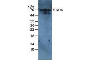 Western blot analysis of Rat Liver Tissue. (IL-6 Receptor Antikörper  (AA 385-462))