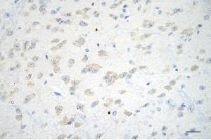 Immunohistochemistry was performed on paraffin-embedded mouse brain using ADAM17 antibody (ABIN7797502), 1:200). (Rekombinanter ADAM17 Antikörper)