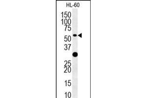 TRAF3 Antibody (C-term) (ABIN657866 and ABIN2846822) western blot analysis in HL-60 cell line lysates (35 μg/lane). (TRAF3 Antikörper  (C-Term))