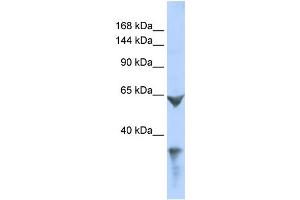 WB Suggested Anti-LRP1 Antibody Titration: 0. (LRP1 Antikörper  (Middle Region))