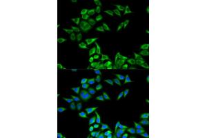 Immunofluorescence analysis of MCF-7 cells using CHMP2B antibody (ABIN6131571, ABIN6138545, ABIN6138547 and ABIN6217398).