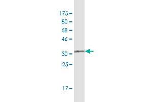 Western Blotting (WB) image for anti-CD5 (CD5) (AA 403-495) antibody (ABIN947650)