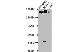 Western Blot Positive WB detected in: SH-SY5Y whole cell lysate, MCF-7 whole cell lysate, 293T whole cell lysate All lanes: LAMA4 antibody at 1:1000 Secondary Goat polyclonal to rabbit IgG at 1/50000 dilution Predicted band size: 203, 202, 13 kDa Observed band size: 203 kDa (LAMa4 Antikörper  (AA 1593-1823))