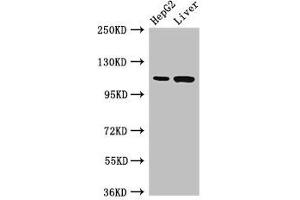 Western Blot Positive WB detected in: HepG2 whole cell lysate, Rat liver tissue All lanes: Tmprss15 antibody at 3 μg/mL Secondary Goat polyclonal to rabbit IgG at 1/50000 dilution Predicted band size: 119 kDa Observed band size: 119 kDa (TMPRSS15 Antikörper  (AA 830-1069))