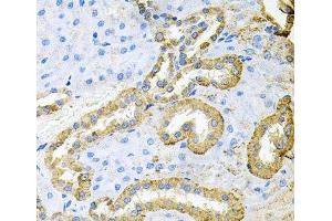 Immunohistochemistry of paraffin-embedded Rat kidney using ABL1 Polyclonal Antibody at dilution of 1:100 (40x lens). (ABL1 Antikörper)