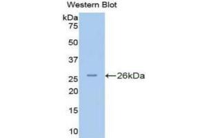 Western blot analysis of the recombinant protein. (PKN2 Antikörper  (AA 282-487))