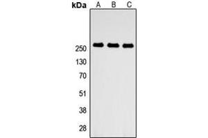 Western blot analysis of ABCA4 expression in HEK293T (A), NS-1 (B), PC12 (C) whole cell lysates. (ABCA4 Antikörper  (Center))