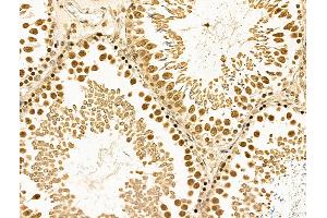 ABIN6261140 and ABIN6268860 at 1/100 staining Rat testis tissue by IHC-P. (Cyclin A1 Antikörper  (C-Term))