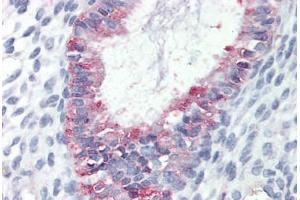 Human Uterus (formalin-fixed, paraffin-embedded) stained with GPR27 antibody ABIN410771 followed by biotinylated goat anti-rabbit IgG secondary antibody ABIN481713, alkaline phosphatase-streptavidin and chromogen. (GPR27 Antikörper  (Internal Region))