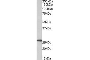 ABIN5539473 (1µg/ml) staining of Human Adipose lysate (35µg protein in RIPA buffer). (Adipsin Antikörper  (Internal Region))