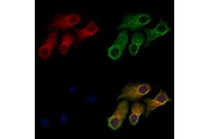ABIN6257460 and ABIN6273388 staining HepG2 cells by IF/ICC. (RIOK2 Antikörper  (Internal Region))