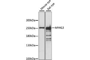 Western blot analysis of extracts of various cell lines, using MYH13 antibody (ABIN7268746) at 1:1000 dilution.