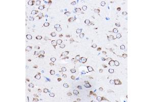 Immunohistochemistry of paraffin-embedded mouse brain using RPL8 Rabbit pAb (ABIN6128659, ABIN6147155, ABIN6147156 and ABIN6214154) at dilution of 1:50 (40x lens).