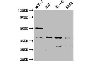 Western Blot Positive WB detected in: MCF-7 whole cell lysate, 293 whole cell lysate, HL60 whole cell lysate, K562 whole cell lysate All lanes: MRGPRX2 antibody at 1:2000 Secondary Goat polyclonal to rabbit IgG at 1/50000 dilution Predicted band size: 38 kDa Observed band size: 38 kDa (MRGPRX2 Antikörper  (AA 286-330))
