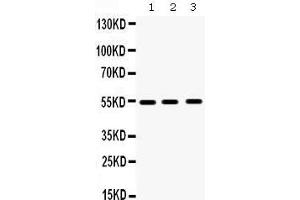 Western Blotting (WB) image for anti-Matrix Metallopeptidase 10 (Stromelysin 2) (MMP10) (AA 409-443), (C-Term) antibody (ABIN3043406) (MMP10 Antikörper  (C-Term))