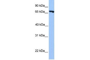 WB Suggested Anti-PRDM6 Antibody Titration:  0. (PRDM6 Antikörper  (N-Term))