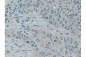 Immunohistochemistry (IHC) image for anti-Synaptosomal-Associated Protein, 25kDa (SNAP25) (AA 1-206) antibody (ABIN7443431)