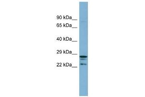 CUTC antibody used at 1 ug/ml to detect target protein. (CUTC Antikörper)