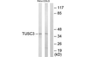 Western blot analysis of extracts from COLO205/HeLa cells, using TUSC3 Antibody. (TUSC3 Antikörper  (AA 131-180))