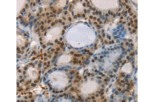 Immunohistochemistry (IHC) image for anti-Runt-Related Transcription Factor 1, Translocated To, 1 (Cyclin D-Related) (RUNX1T1) antibody (ABIN2427103) (RUNX1T1 Antikörper)