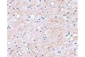 Immunohistochemical staining of human brain tissue using LGI1 polyclonal antibody  at 2. (LGI1 Antikörper  (Internal Region))