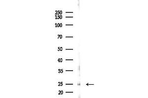 Western blot analysis of lysates from Hela cells(starvation 24h treatment), using PRRG1 Antibody at 1/1000 dilution.