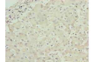 Immunohistochemistry of paraffin-embedded human liver tissue using ABIN7142833 at dilution of 1:100 (RPL7L1 Antikörper  (AA 1-246))