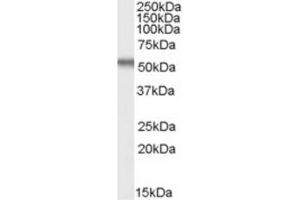 Image no. 1 for anti-Early Growth Response 2 (EGR2) (Internal Region) antibody (ABIN375194) (EGR2 Antikörper  (Internal Region))